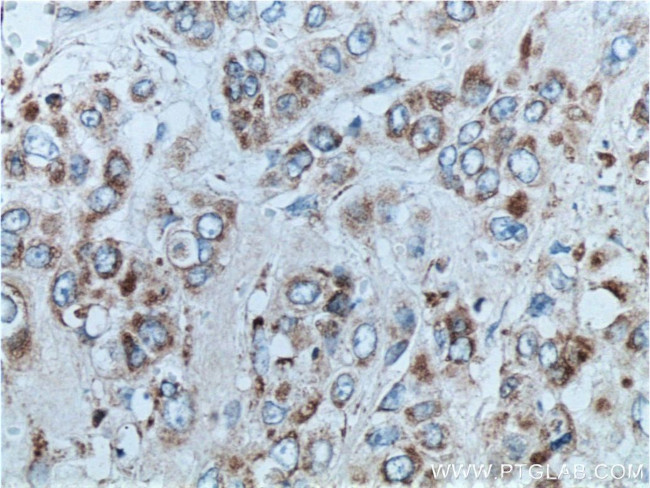 ETHE1 Antibody in Immunohistochemistry (Paraffin) (IHC (P))