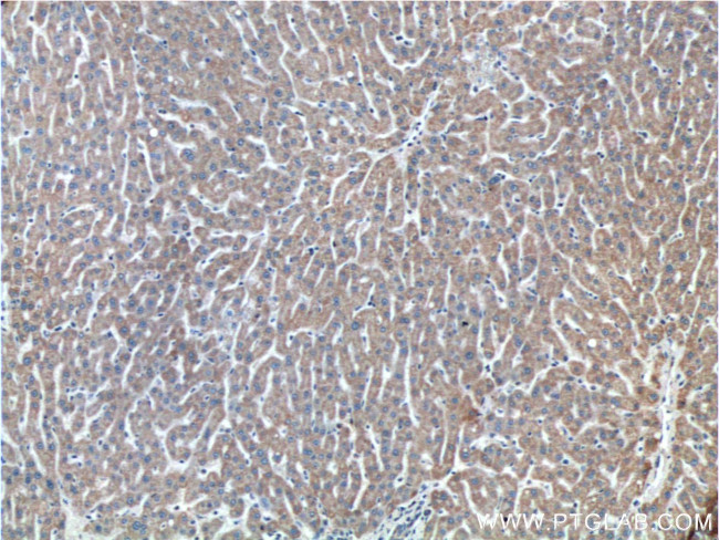 ETHE1 Antibody in Immunohistochemistry (Paraffin) (IHC (P))