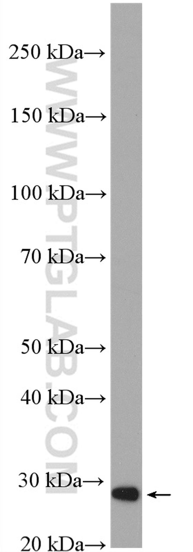 ETHE1 Antibody in Western Blot (WB)