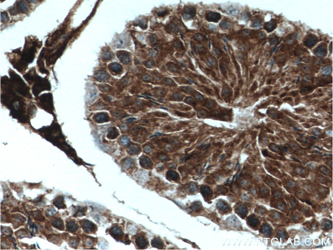 USP8 Antibody in Immunohistochemistry (Paraffin) (IHC (P))