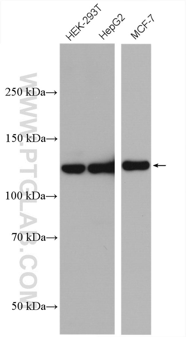 USP8 Antibody in Western Blot (WB)