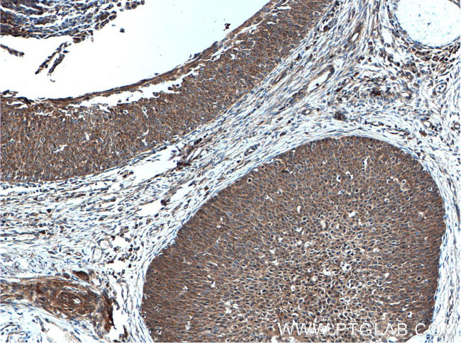 OSM Antibody in Immunohistochemistry (Paraffin) (IHC (P))