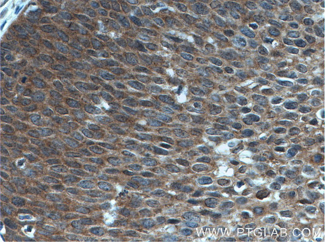 OSM Antibody in Immunohistochemistry (Paraffin) (IHC (P))