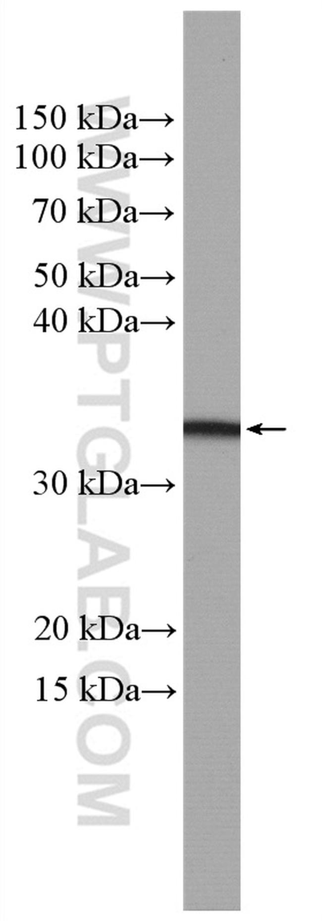 OSM Antibody in Western Blot (WB)