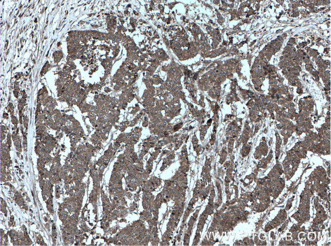 OSM Antibody in Immunohistochemistry (Paraffin) (IHC (P))