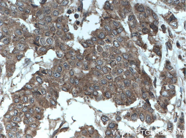 OSM Antibody in Immunohistochemistry (Paraffin) (IHC (P))