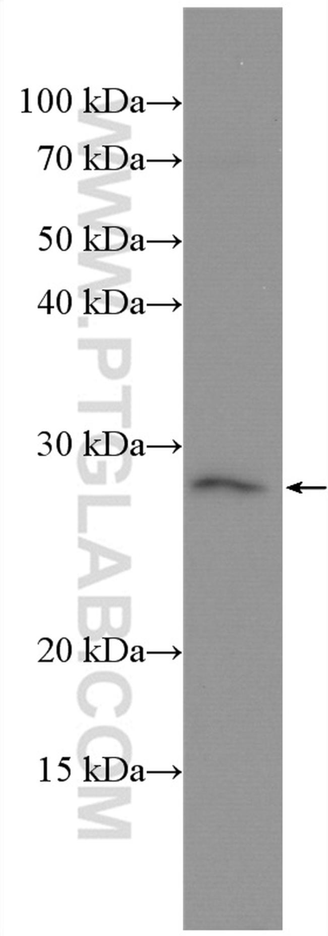 OSM Antibody in Western Blot (WB)