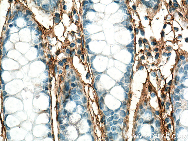 Periostin Antibody in Immunohistochemistry (Paraffin) (IHC (P))