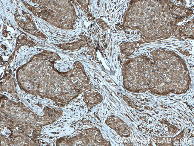 PARG Antibody in Immunohistochemistry (Paraffin) (IHC (P))