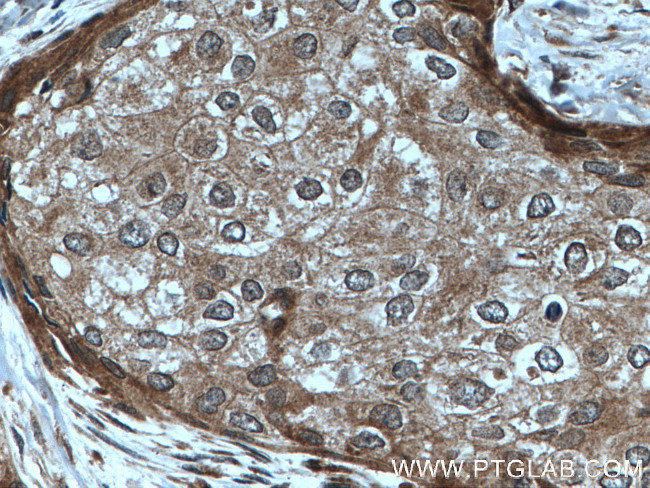 PARG Antibody in Immunohistochemistry (Paraffin) (IHC (P))