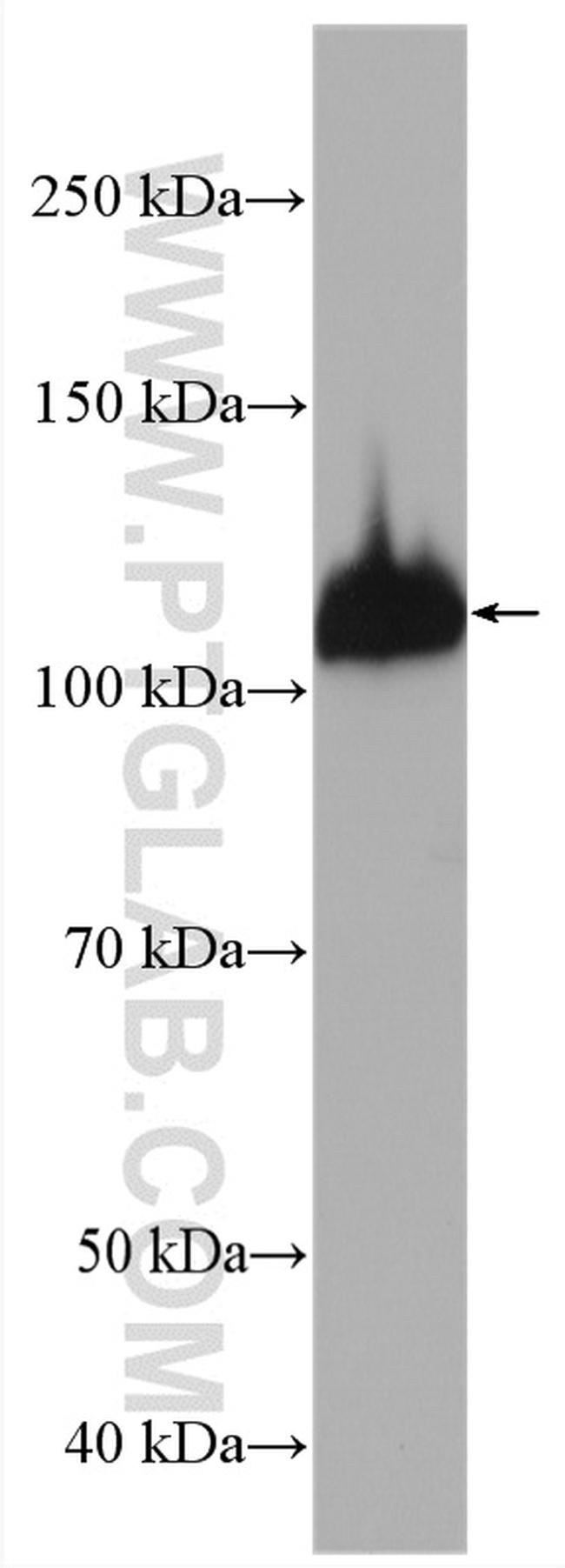 PARG Antibody in Western Blot (WB)