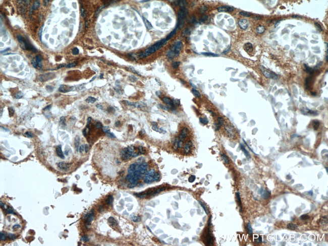 ABP1 Antibody in Immunohistochemistry (Paraffin) (IHC (P))