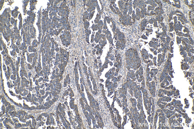 CD151 Antibody in Immunohistochemistry (Paraffin) (IHC (P))