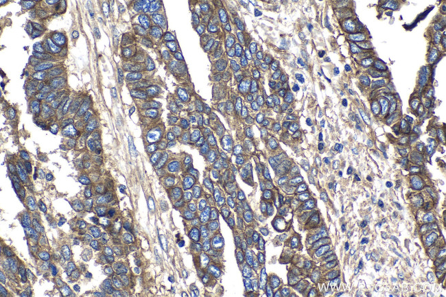 CD151 Antibody in Immunohistochemistry (Paraffin) (IHC (P))