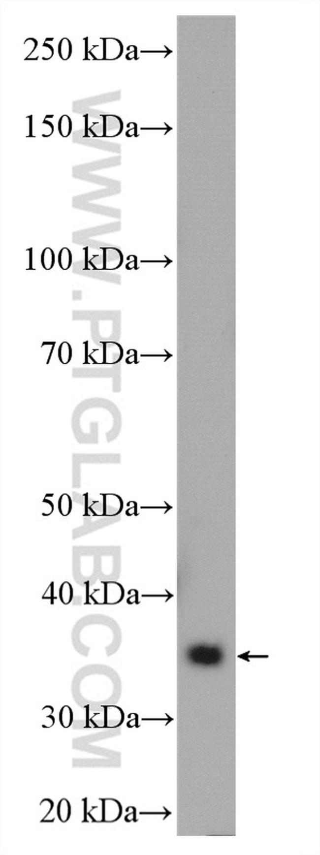 HAPLN2 Antibody in Western Blot (WB)