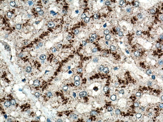 LAMP2 Antibody in Immunohistochemistry (Paraffin) (IHC (P))