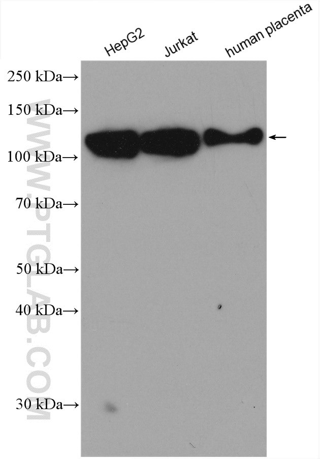 LAMP2 Antibody in Western Blot (WB)