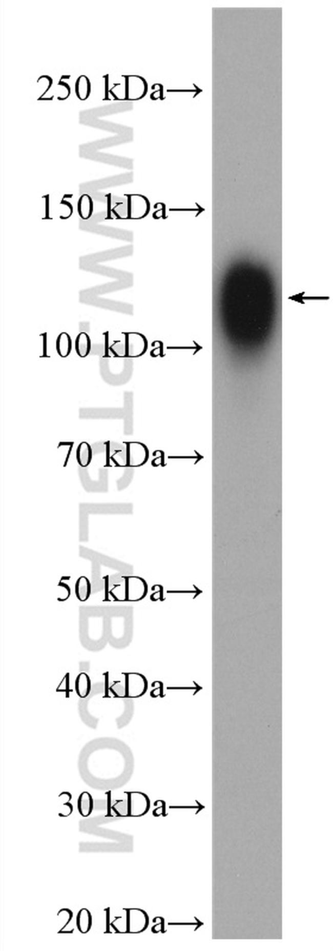 LAMP2 Antibody in Western Blot (WB)