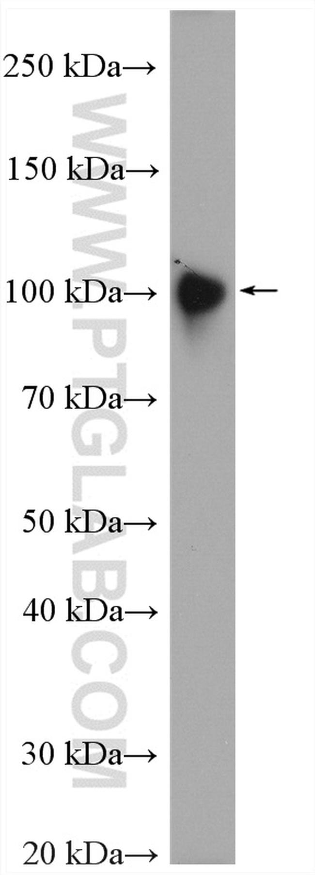 LAMP2 Antibody in Western Blot (WB)