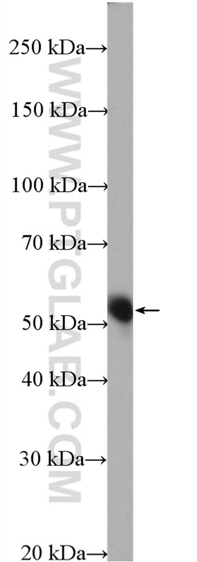 SIGIRR Antibody in Western Blot (WB)