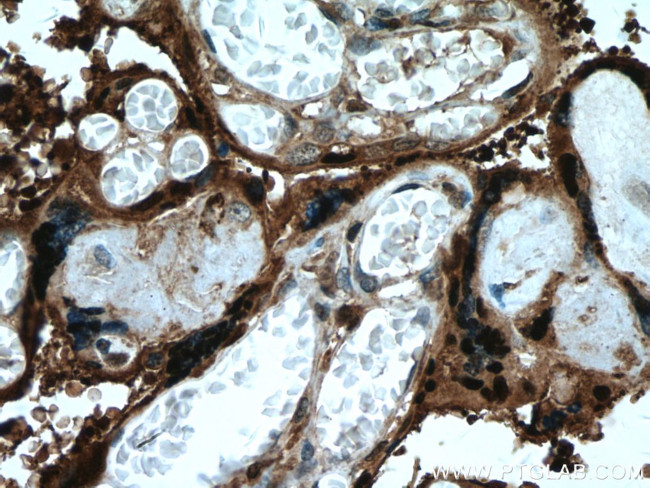 HSD17B1 Antibody in Immunohistochemistry (Paraffin) (IHC (P))