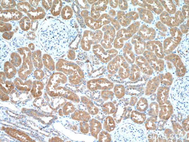 HSD17B1 Antibody in Immunohistochemistry (Paraffin) (IHC (P))