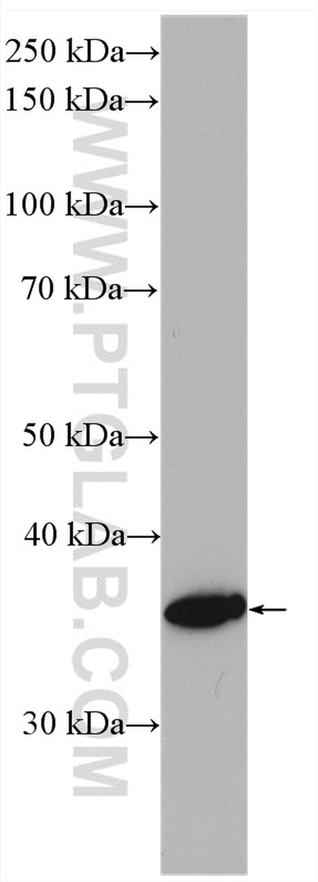 HSD17B1 Antibody in Western Blot (WB)