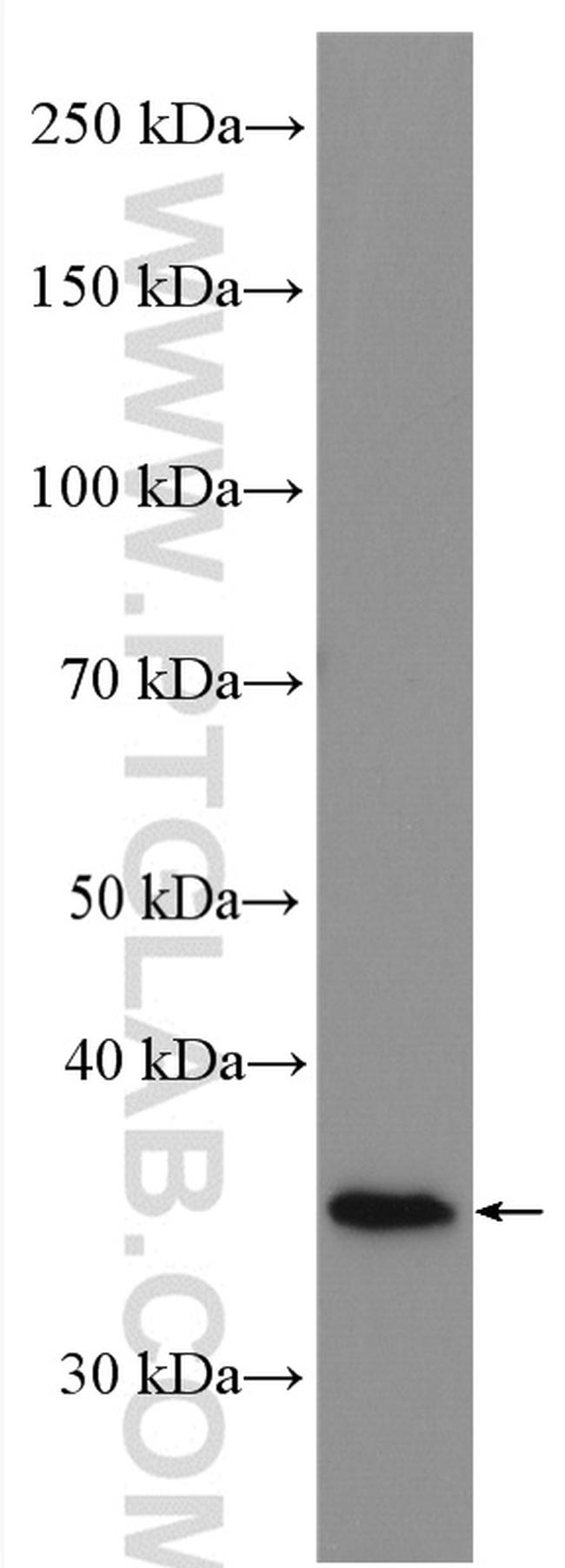 HSD17B1 Antibody in Western Blot (WB)