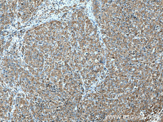 FMNL1 Antibody in Immunohistochemistry (Paraffin) (IHC (P))