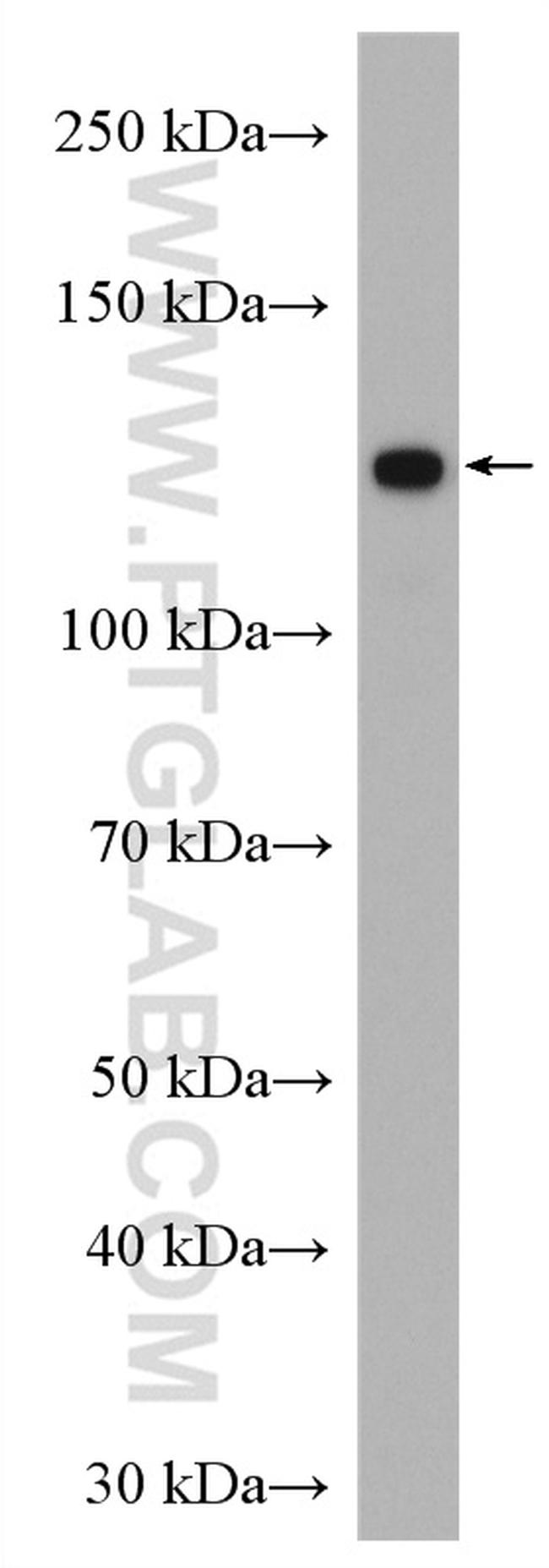 FMNL1 Antibody in Western Blot (WB)