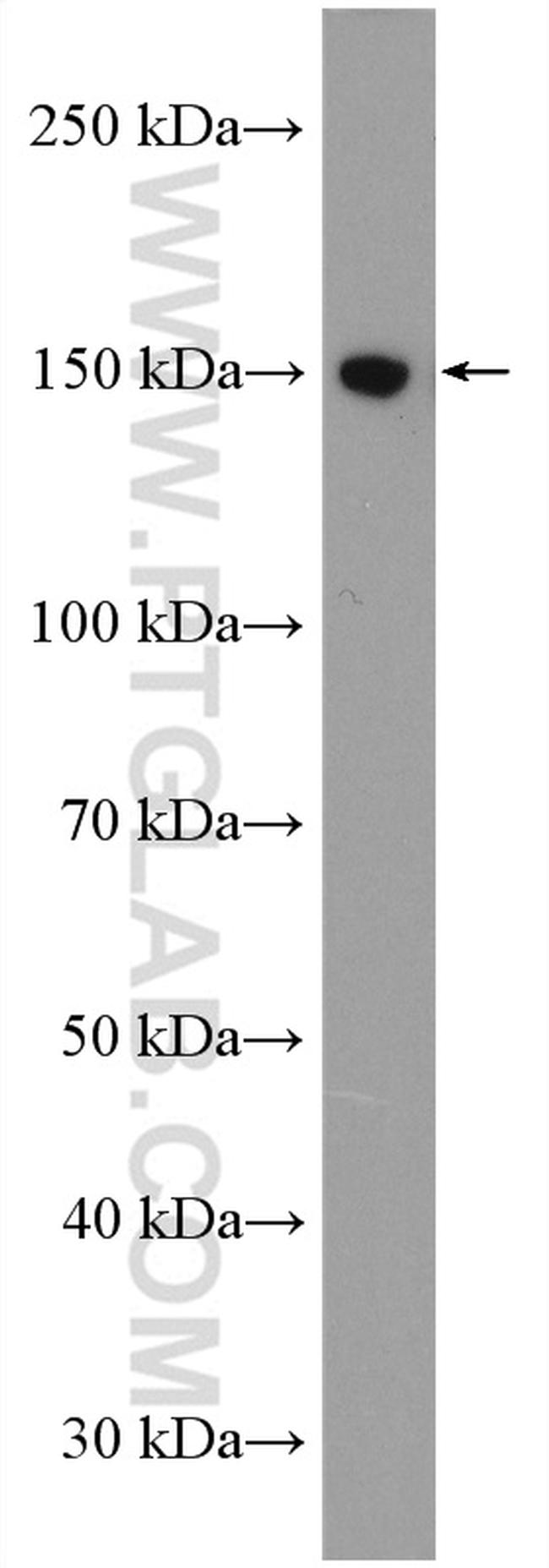 FMNL1 Antibody in Western Blot (WB)