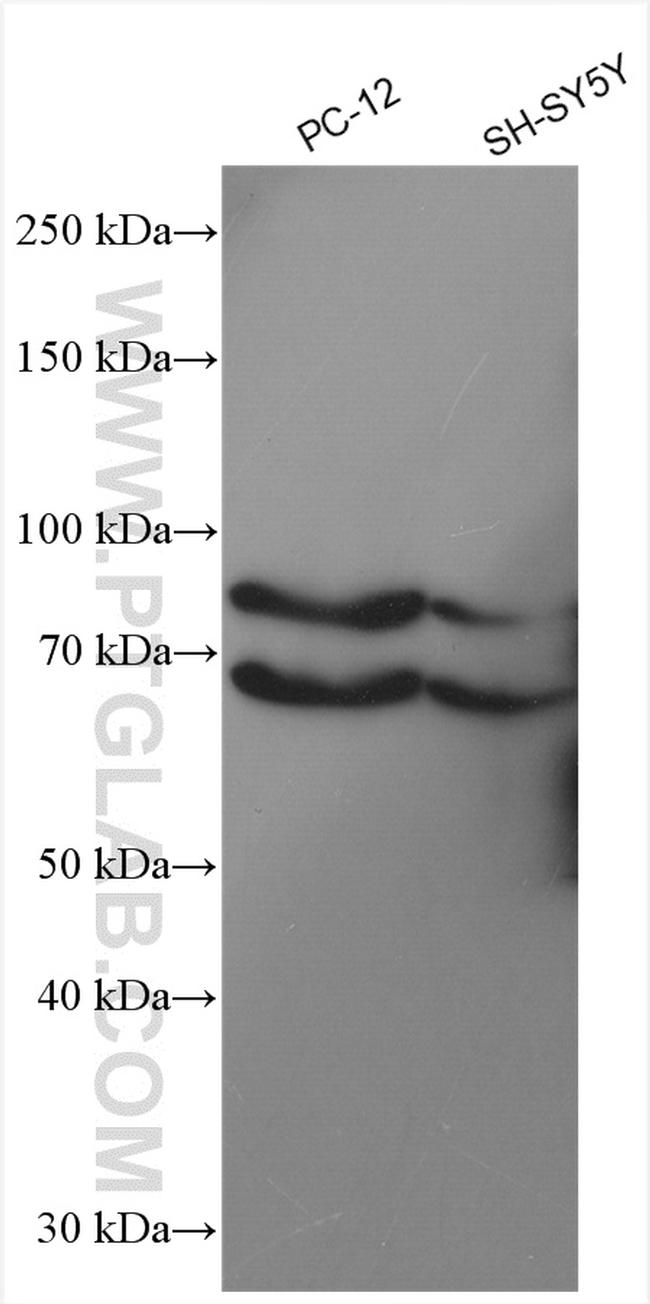 SEMA3A Antibody in Western Blot (WB)