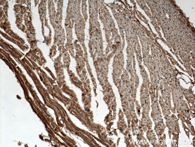 C22orf25 Antibody in Immunohistochemistry (Paraffin) (IHC (P))