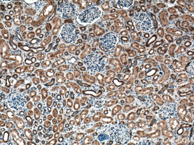 C22orf25 Antibody in Immunohistochemistry (Paraffin) (IHC (P))