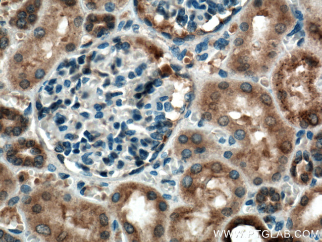 C22orf25 Antibody in Immunohistochemistry (Paraffin) (IHC (P))