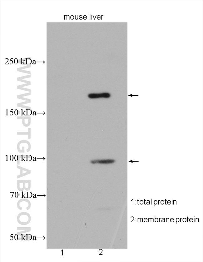 ABCC6 Antibody in Western Blot (WB)