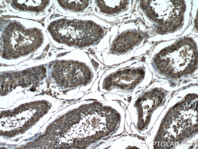 GDPD1 Antibody in Immunohistochemistry (Paraffin) (IHC (P))