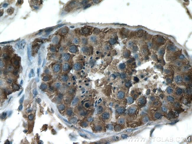 GDPD1 Antibody in Immunohistochemistry (Paraffin) (IHC (P))