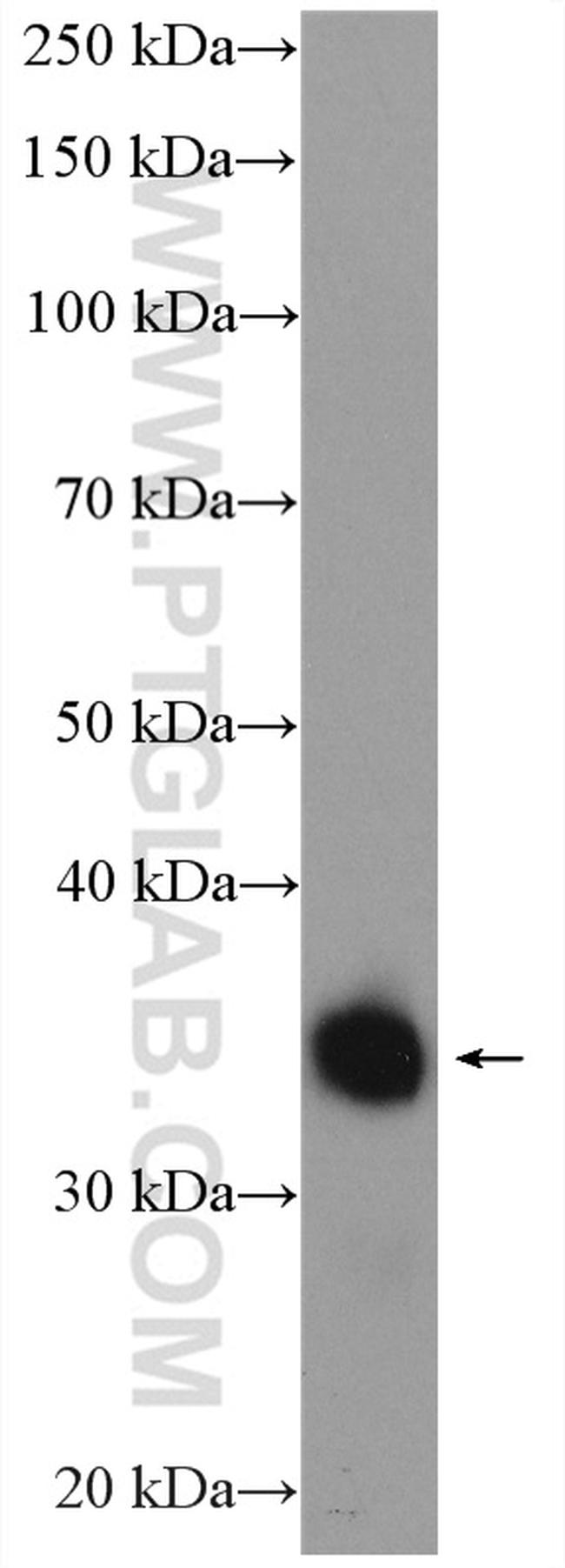 GDPD1 Antibody in Western Blot (WB)