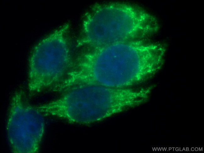 Titin Antibody in Immunocytochemistry (ICC/IF)