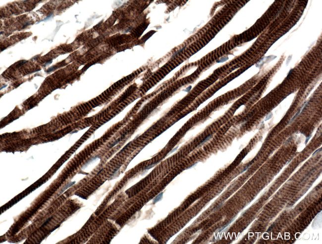 Titin Antibody in Immunohistochemistry (Paraffin) (IHC (P))