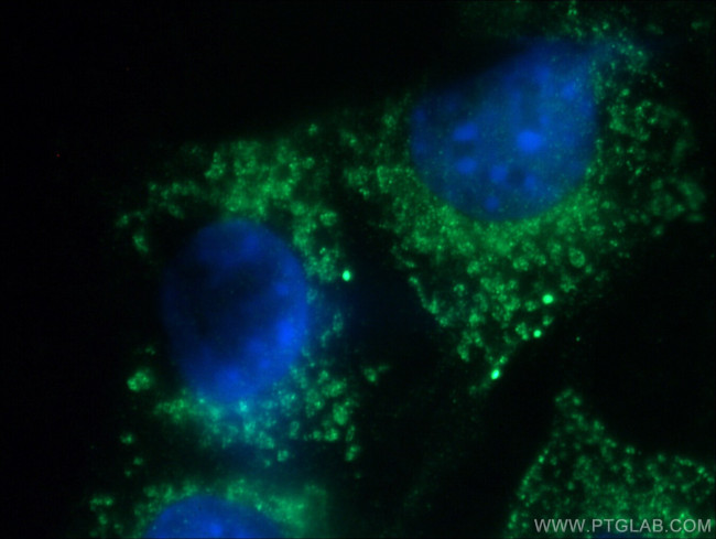 SLC25A46 Antibody in Immunocytochemistry (ICC/IF)