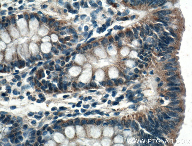 SLC25A46 Antibody in Immunohistochemistry (Paraffin) (IHC (P))