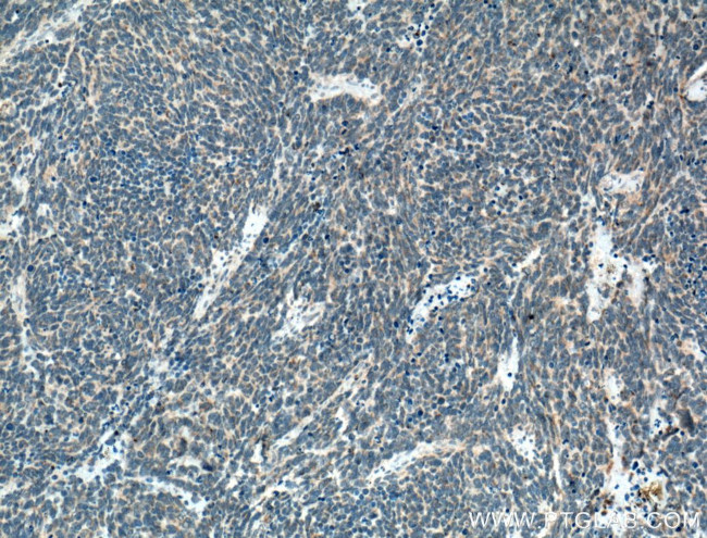 SLC25A46 Antibody in Immunohistochemistry (Paraffin) (IHC (P))