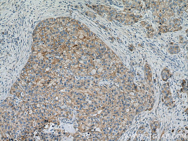 gamma catenin Antibody in Immunohistochemistry (Paraffin) (IHC (P))