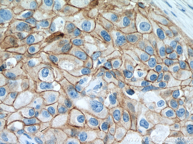 gamma catenin Antibody in Immunohistochemistry (Paraffin) (IHC (P))