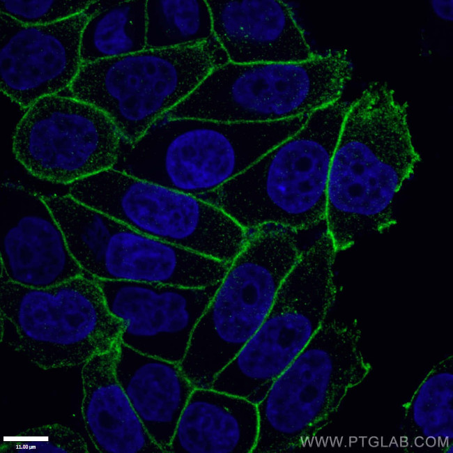 gamma catenin Antibody in Immunocytochemistry (ICC/IF)