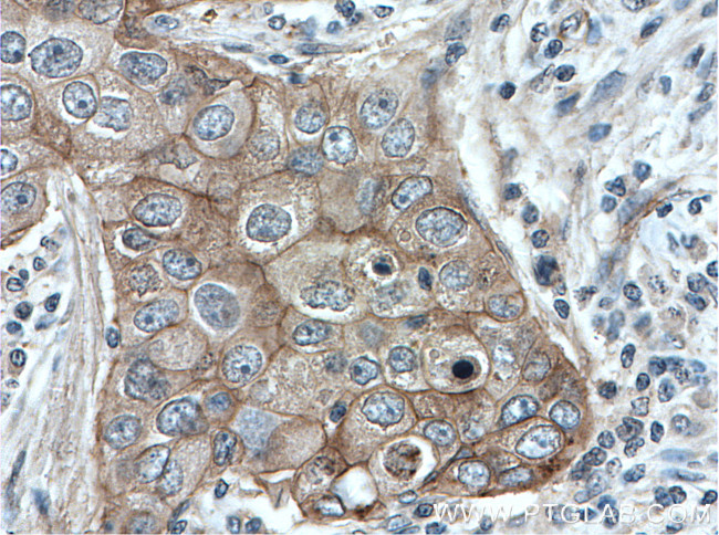 gamma catenin Antibody in Immunohistochemistry (Paraffin) (IHC (P))