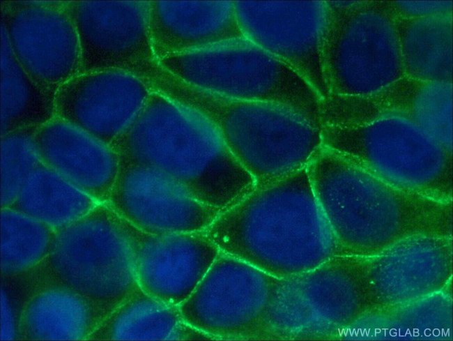 gamma catenin Antibody in Immunocytochemistry (ICC/IF)