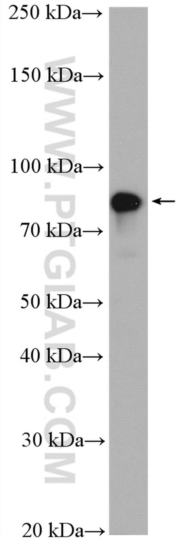 gamma catenin Antibody in Western Blot (WB)